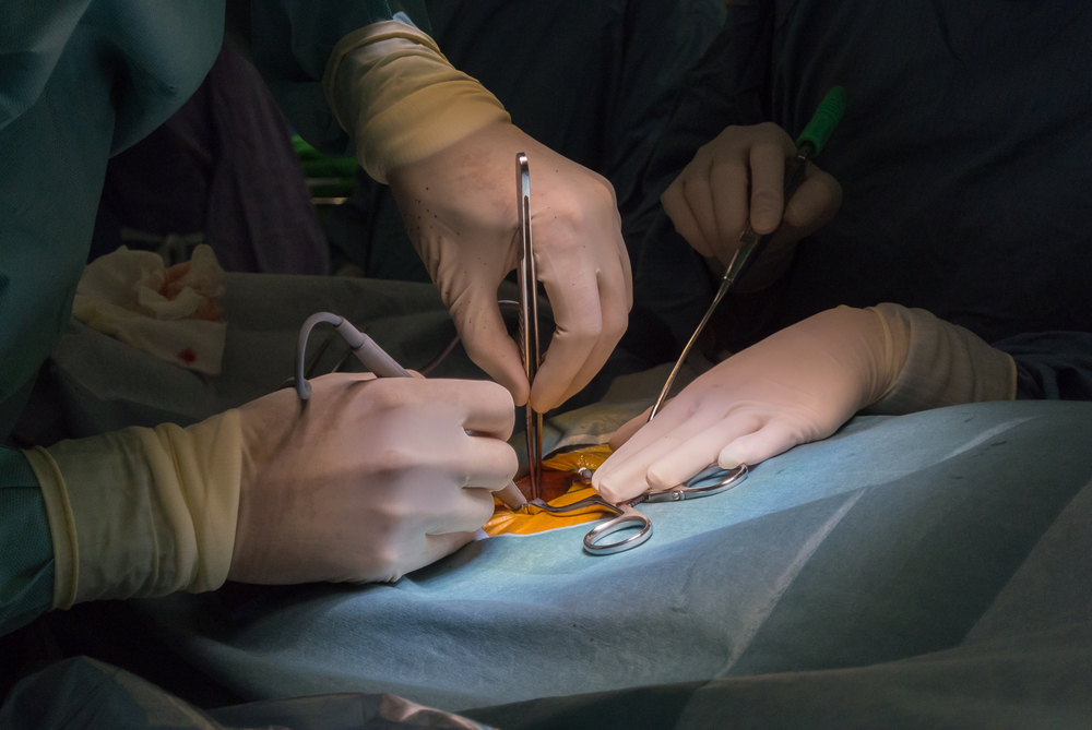 Femoral Artery Aneurysm (ជំងឺ​ប៉ោង​សរសៃ​ឈាមក្រលៀន)