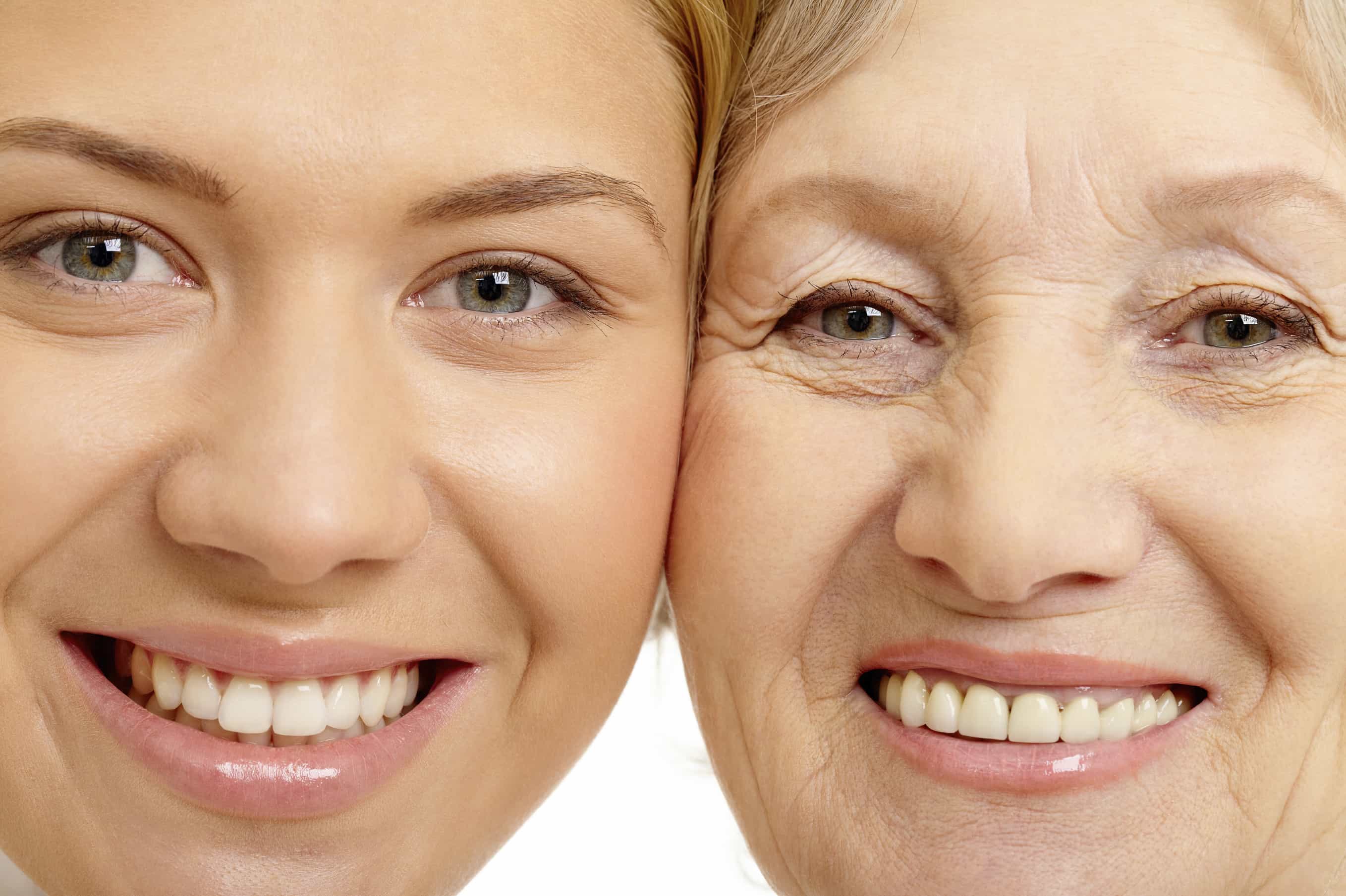 aging-skin-condition