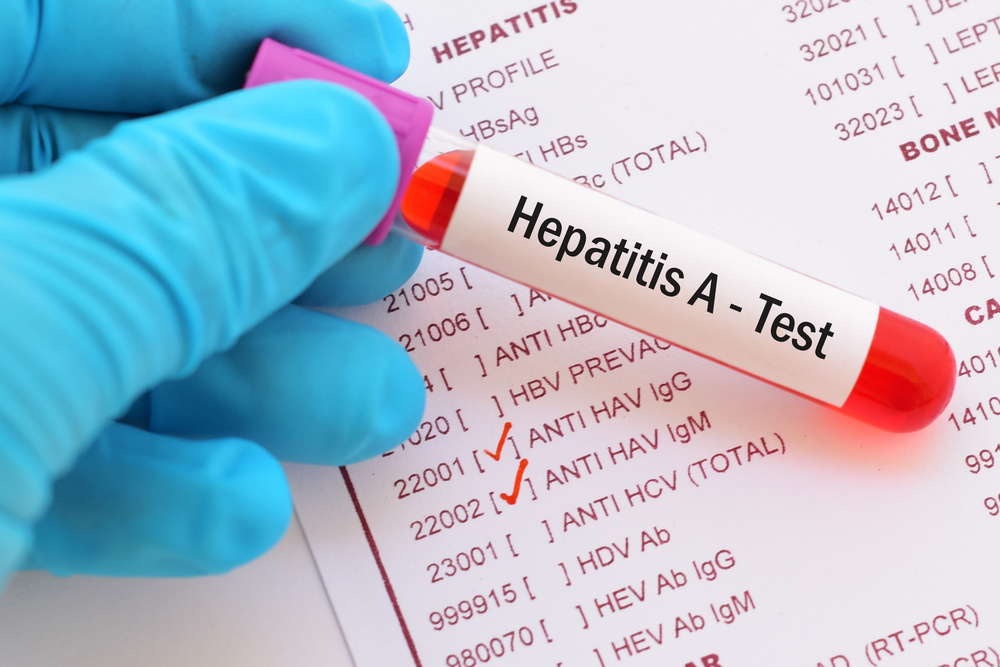 Hepatitis A Virus Test (តេស្តពិនិត្យរកមើលមេរោគរលាកថ្លើមប្រភេទ A)