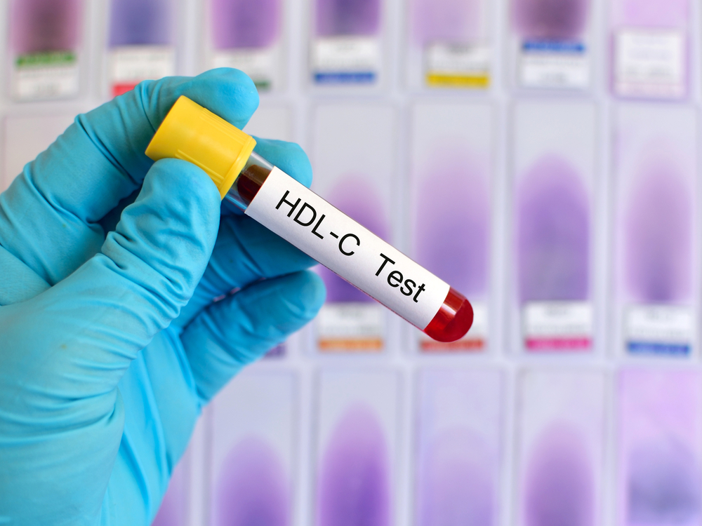 HDL Cholesterol Test (ការធ្វើតេស្ត​កូលេស្តេ​រ៉ូល HDL)