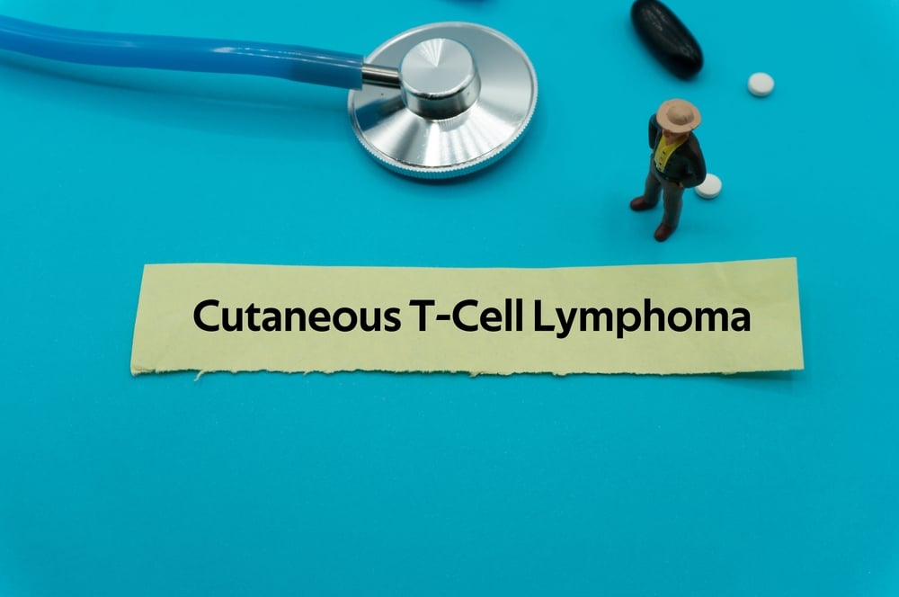 T-cell Lymphoma (មហារីកគ្រាប់ឈាមស)