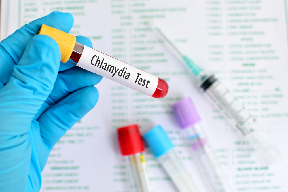 Chlamydia (តេស្តរកមើលមេរោគប្រមេះទឹកថ្លា)