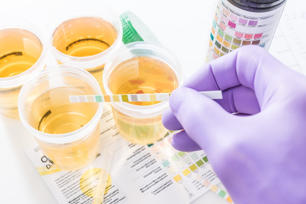 Toxicology Test (តេស្ត​ពិនិត្យ​ជាតិពុល)