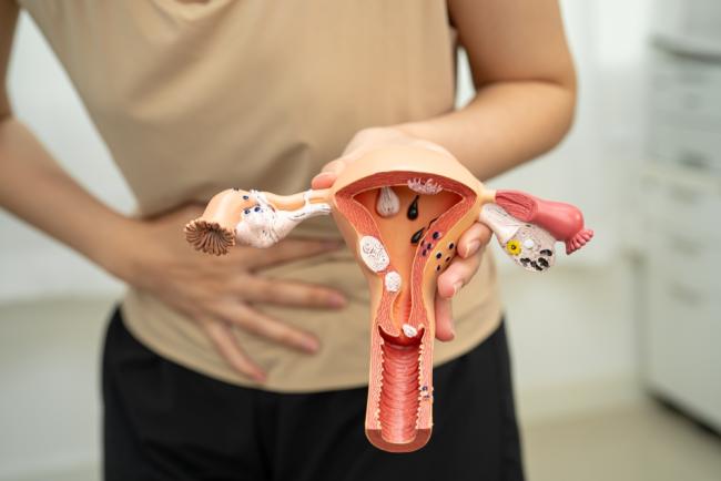 Uterine Prolapse (ជំងឺស្រុតស្បូន)