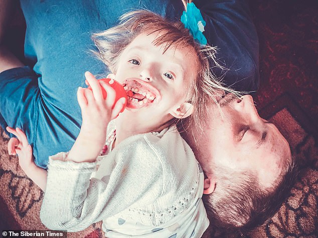 កូនរុស្ស៊ីអភ័ព្វ អត់បបូរមាត់ អត់ចង្កា ហោះទៅព្យាបាលដល់អង់គ្លេស