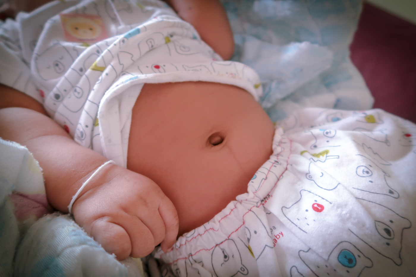 របៀបថែទាំផ្ចិតទារកទើបកើត ឲ្យឆាប់ជ្រុះ គ្មានដំបៅខ្ទុះ