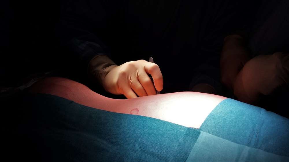 កើតជំងឺរលាកថ្លើមប្រភេទ B ហេតុអីត្រូវប្តូរថ្លើម? ចុះពេទ្យប្តូរ​ថ្លើមដោយវិធីណា?