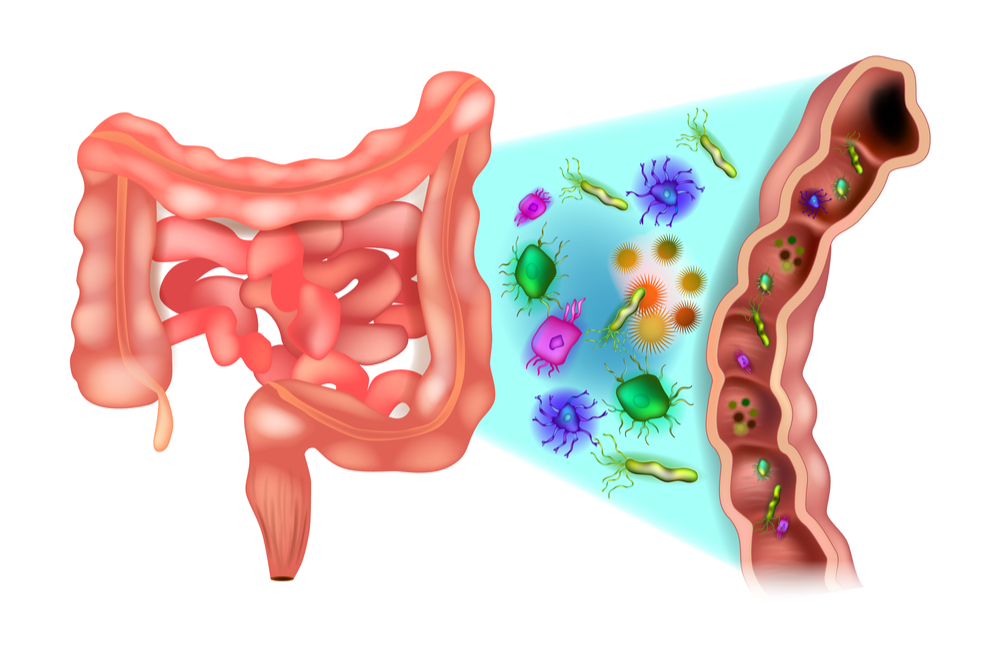 Infectious colitis (ជំងឺរលាក​ពោះវៀន​ធំដោយសារបង្ករោគ)