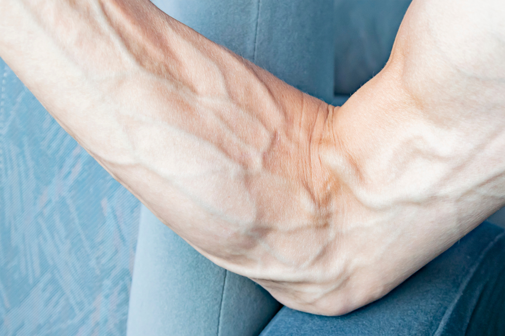 ម៉េចបាន អ្នកខ្លះឡើងសរសៃច្បាស់ៗ?