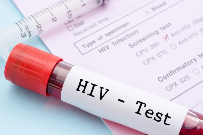 តើមេរោគ​ HIV បំផ្លាញរាងកាយមនុស្សដូចម៉្តេចខ្លះ? មកស្វែងយល់ទាំងអស់គ្នា!