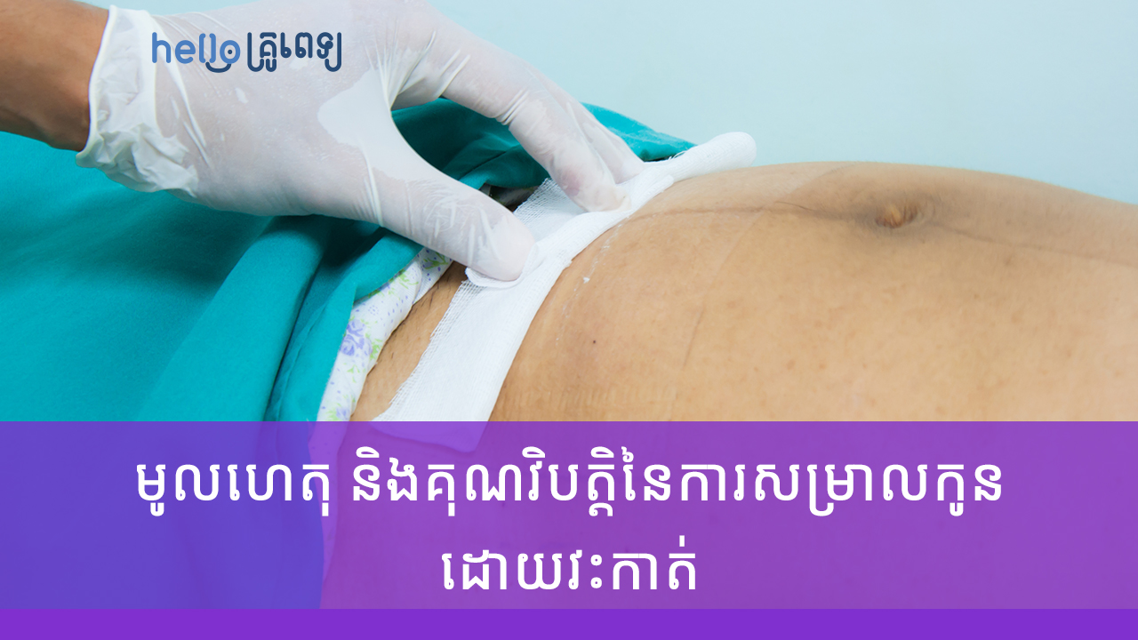 មូលហេតុ និងគុណវិបត្តិនៃការសម្រាលកូនដោយវះកាត់ (វីដេអូ)