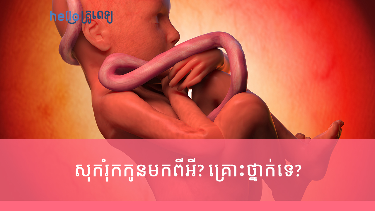 សុក​រុំ​ក​កូន​មក​ពី​អី? គ្រោះ​ថ្នាក់​ទេ? (វីដេអូ)