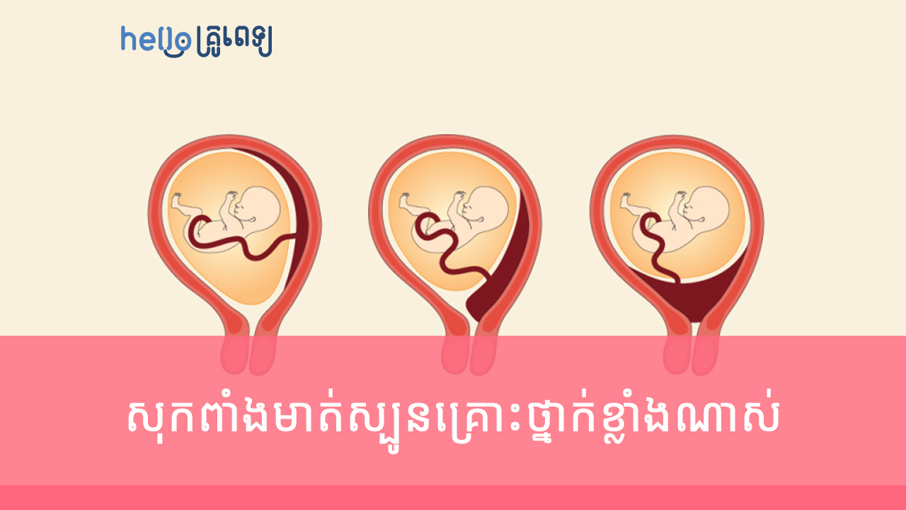 សុក​ពាំង​មាត់​ស្បូន​ពេល​ពពោះគ្រោះថ្នាក់​ខ្លាំង​ណាស់ (វីដេអូ)