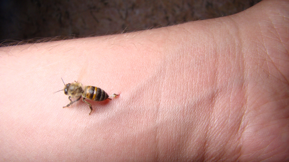 ពេលឃ្មុំទិច អាចសាកល្បងវិធីទាំងនេះ ដើម្បីបន្ថយការឈឺចាប់