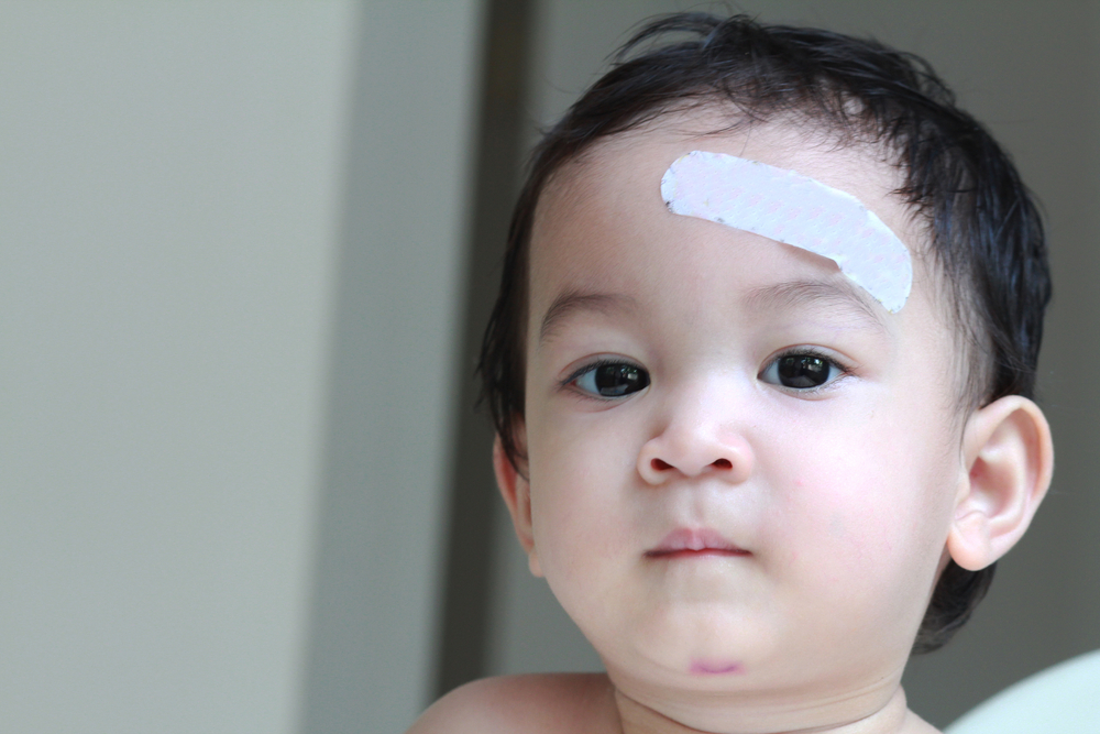 ម៉េចបានជាក្រោយដួលបោកចំក្បាល មានអាការៈក្អួត?