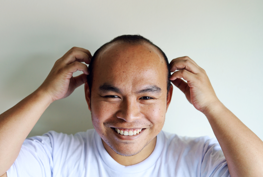 ក្រៅពី​បញ្ហា​តំណពូជ នៅមាន​បញ្ហាអ្វីទៀតធ្វើឲ្យមនុស្សយើងជ្រុះសក់​ដល់ទំពែក?