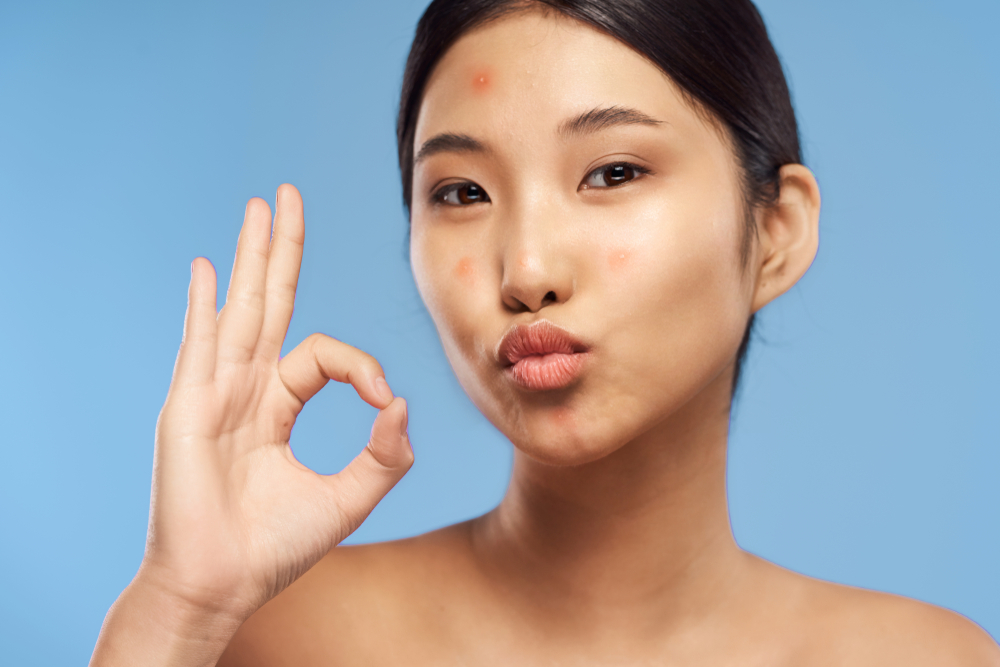 តិចនិក​ងាយ​ៗ​ ធ្វើ​ឲ្យ​ស្បែក​​មុខ​ភ្លឺ​ថ្លា​ត្រឹម​​មួយ​សប្ដាហ៍