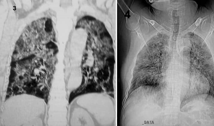 គ្រូពេទ្យជួរមុខនៅពេទ្យខ្មែរសូវៀត ផ្តាំកុំឲ្យចេញក្រៅចម្លងកូវីដមកចាស់ៗ ឈានដល់ស្លាប់