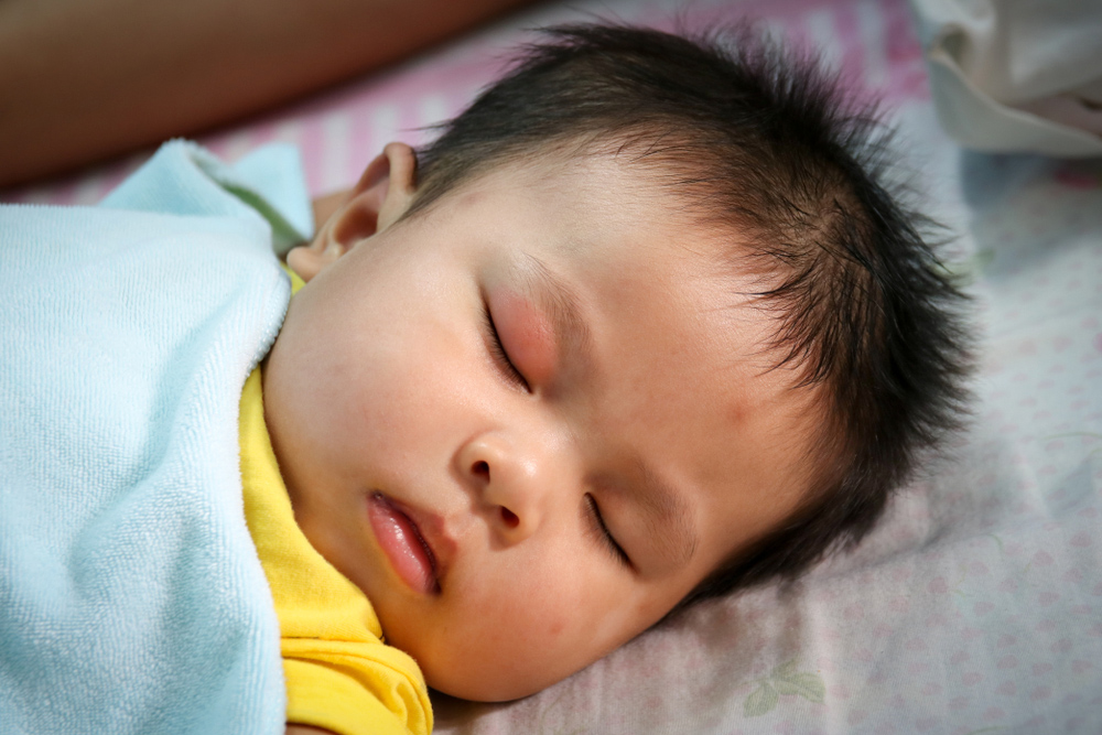 កូន​ហើម​ភ្នែក​បណ្ដាល​មក​ពី​អ្វី​? គួរ​ដោះស្រាយ​បែប​ណា​?​