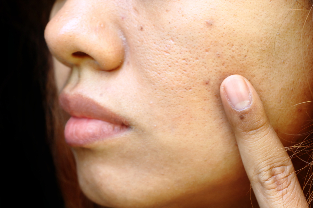 ស្រីៗ​យើង​ដឹង​អត់​? មូលហេតុ​ទាំង​៥​នេះ​ធ្វើ​ឲ្យ​រន្ធ​ញើស​រីក​ធំ