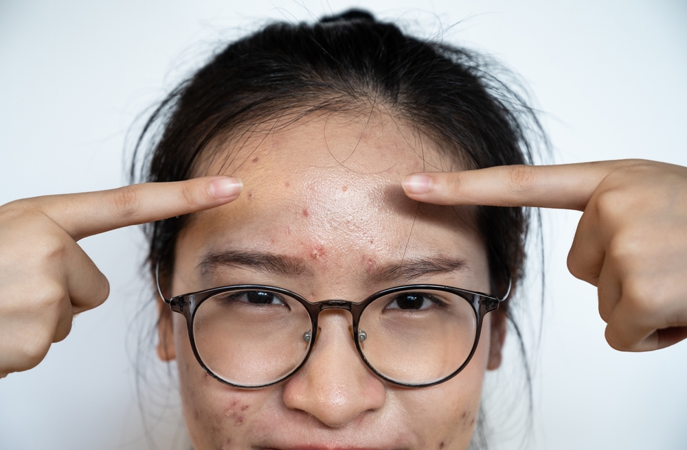 កើត​មុនត្រង់កន្លែងដដែលៗទាំងនេះ អាច​មកពីបញ្ហា​សុខភាពហើយ​​​​​​​​​​​​​​​​​​​​​​​​​​​​​​​​​​​​​​​​​​​​​​​​​​​​​​​​​​​​​​​​​​​​​​​