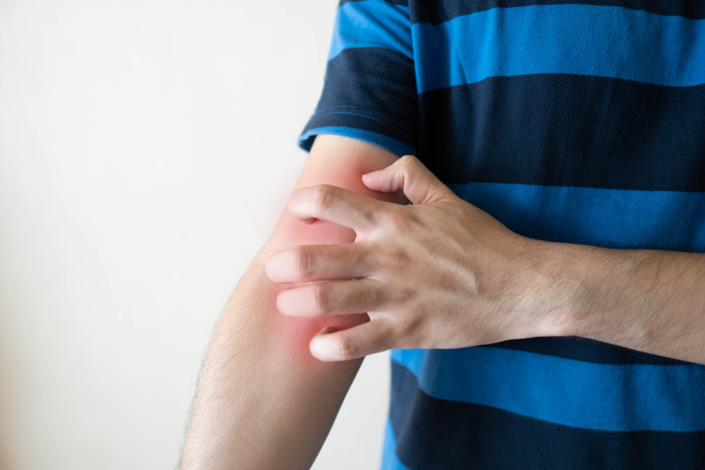 វិធីសាស្រ្ត ៦ យ៉ាងនេះ ជួយការពារខ្លួនពីបញ្ហាកើតស្រែង