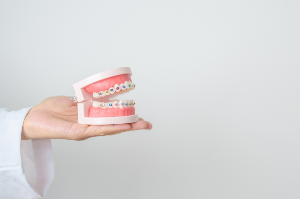 ពាក់ខ្សែពត់ធ្មេញក្លែងក្លាយ អាចប៉ះពាល់សុខភាព ៥ យ៉ាង