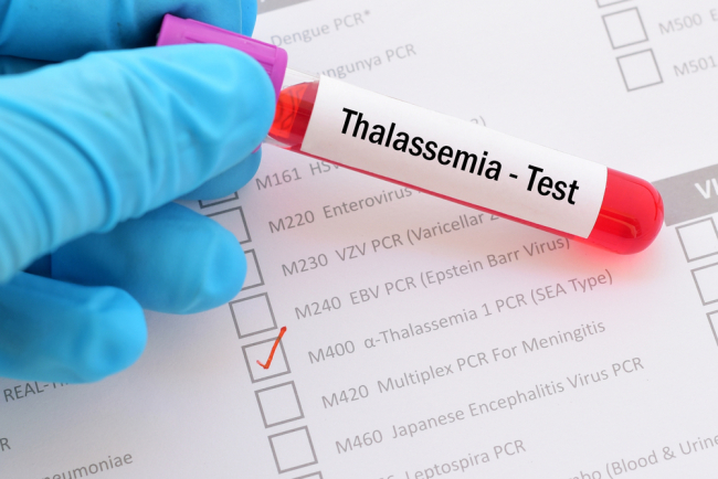អ្នកកើតជំងឺ Thalassemia អាចប្រឈមផលវិបាកទាំងនេះច្រើន