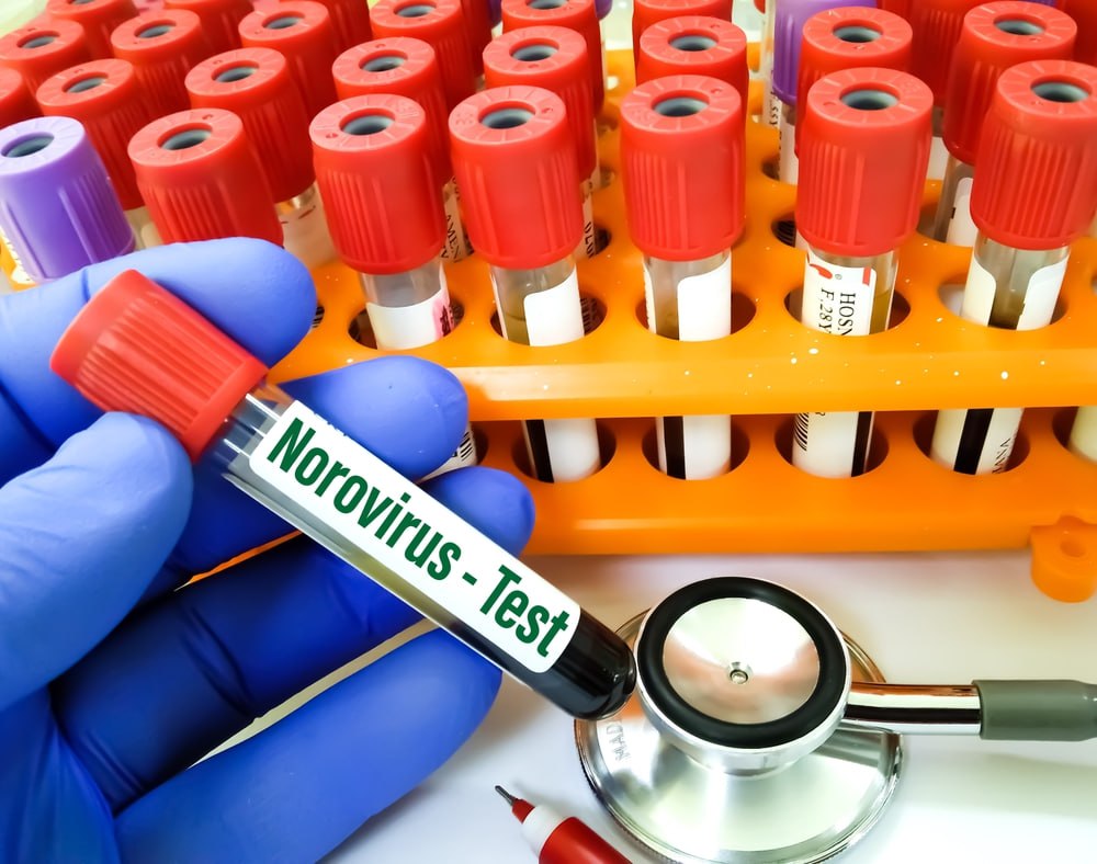 តោះមកដឹងពីវិធីបង្ការជំងឺបង្កឡើងដោយវីរុសណូរ៉ូ (Norovirus)
